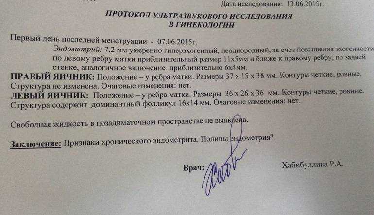 Фолликулометрия: описание и цели методики, расшифровка результатов