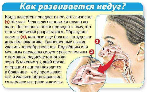 К чему снятся сопли с кровью. сонник: к чему снятся сопли? сонник сопли зеленые