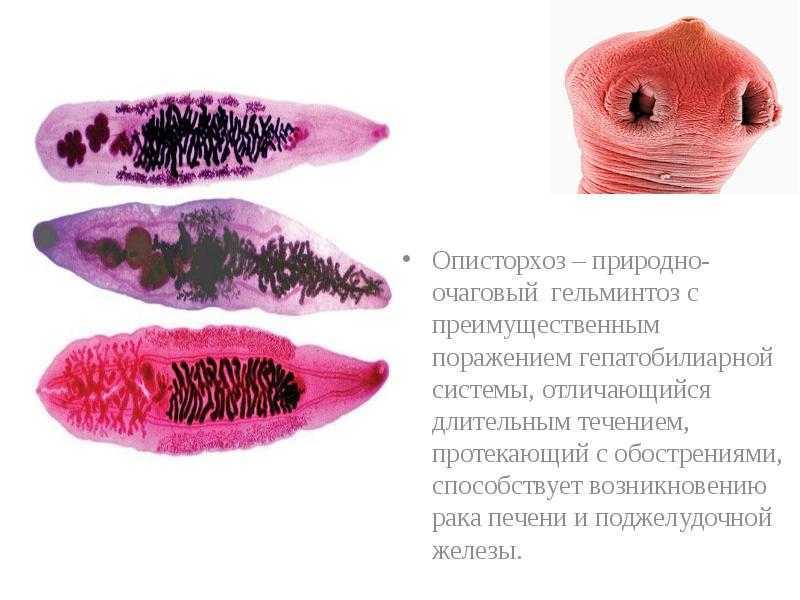 Описторхоз у взрослых, симптомы и схема лечения