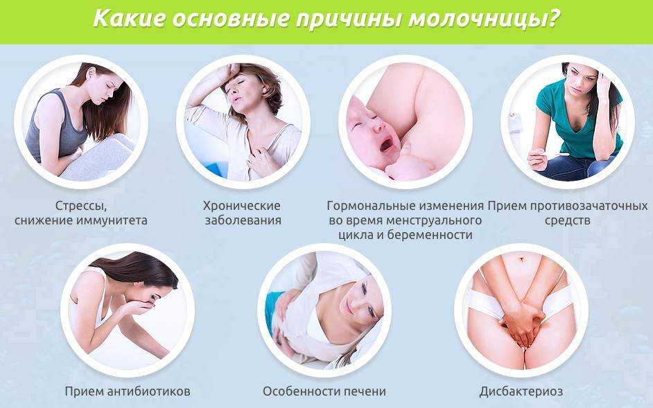 Молочница – причины, симптомы и лечение | московская венерология