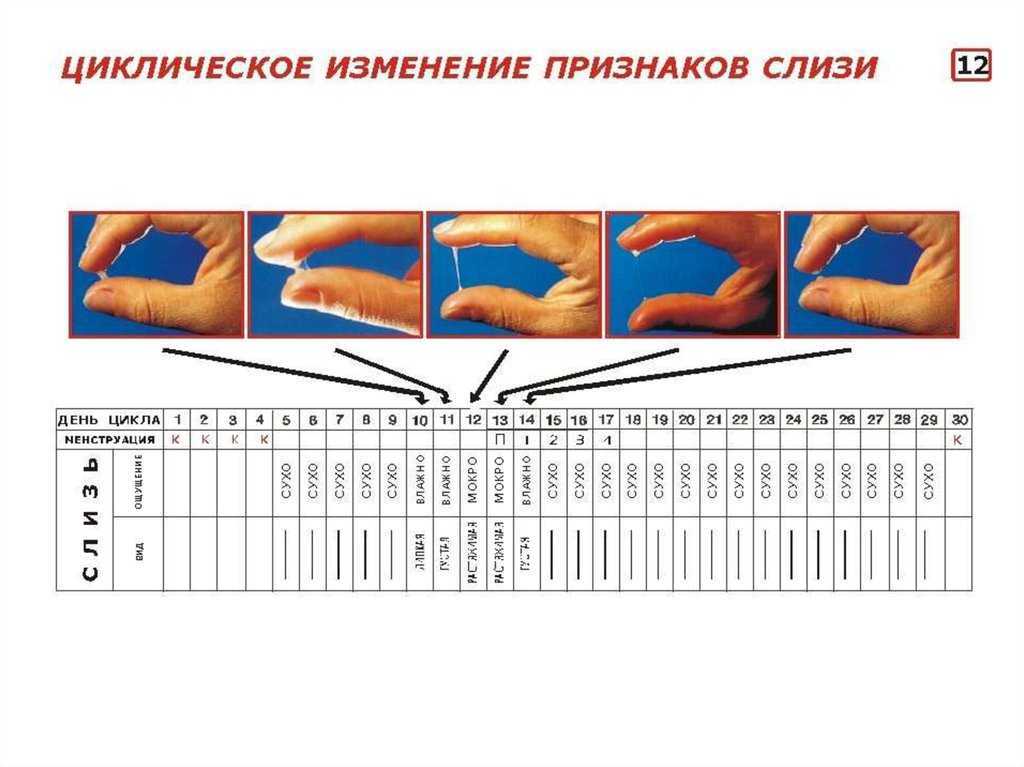 Ановуляция