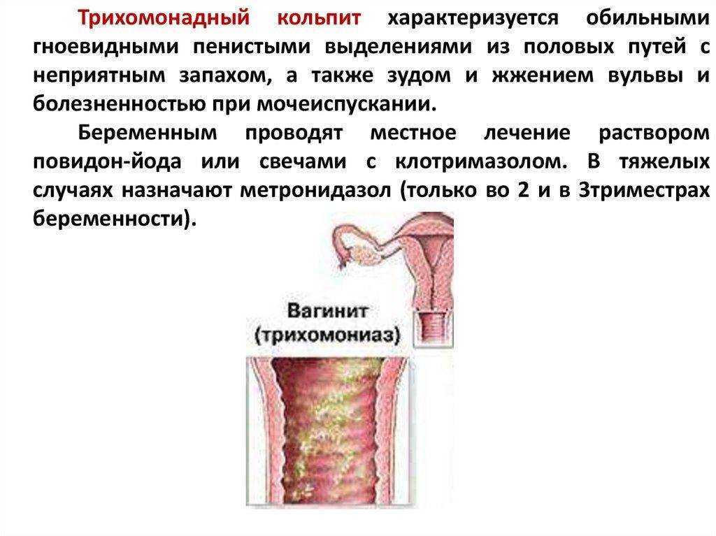 Вульвовагинит | университетская клиника в спб