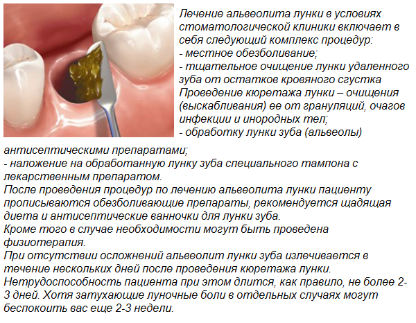 Сколько можно ходить с временной пломбой