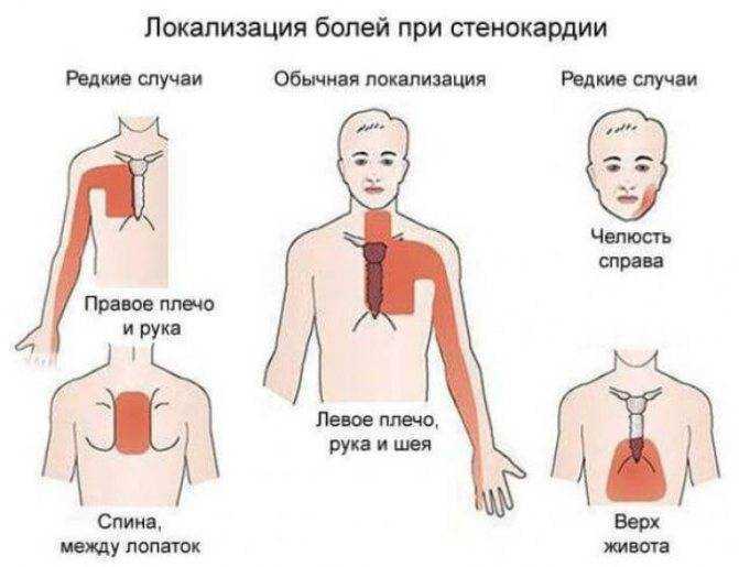 Боли в сердце и болит голова: причины, диагностика и лечение | ким