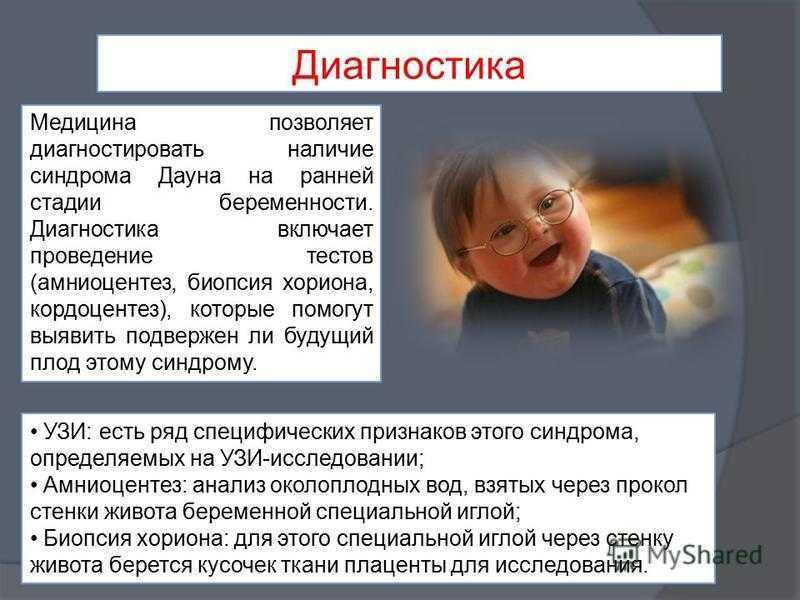 Синдром дауна: сдать анализ в лаборатории kdlmed