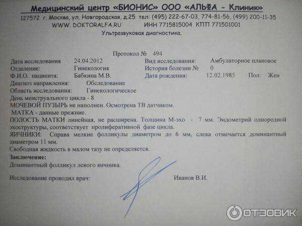 Отследить овуляцию по узи