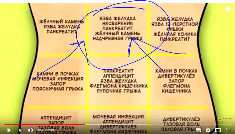 Язвенная болезнь  желудка и двенадцатиперстной кишки