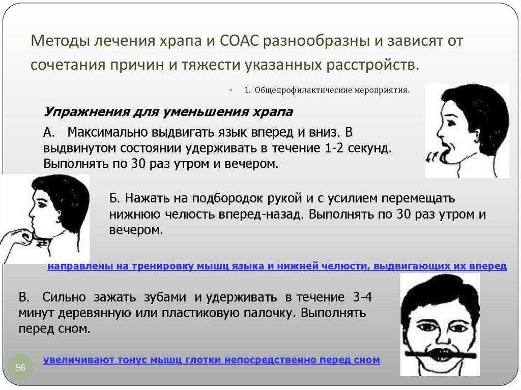 10 эффективных способов избавиться от храпа