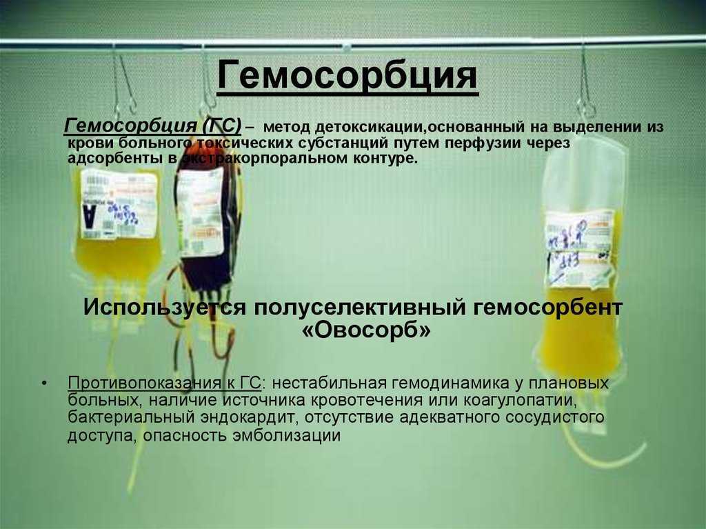 Гемокоррекция - очищение крови | отделение гравитационной хирургии крови клинического госпиталя на яузе
