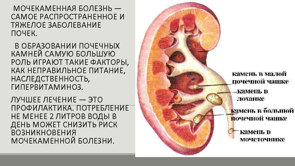 Инфекция мочевыводящих путей: как обнаружить и как вылечить