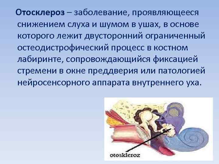 Шум в ушах