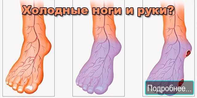 Почему ноги мерзнут у женщин: причины и симптомы – эл клиника