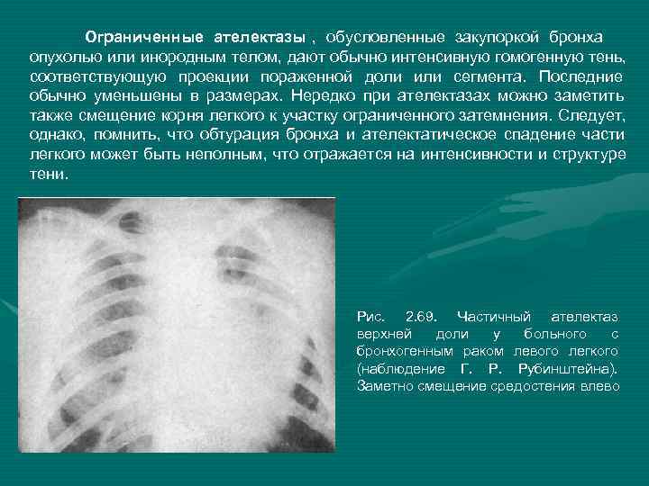 В чем разница между рентгенографией легких и флюорографией