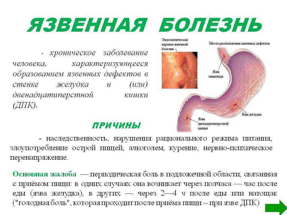 Хронический колит кишечника: симптомы, диагностика, лечение хронического колита – отделение государственной больницы цкб ран