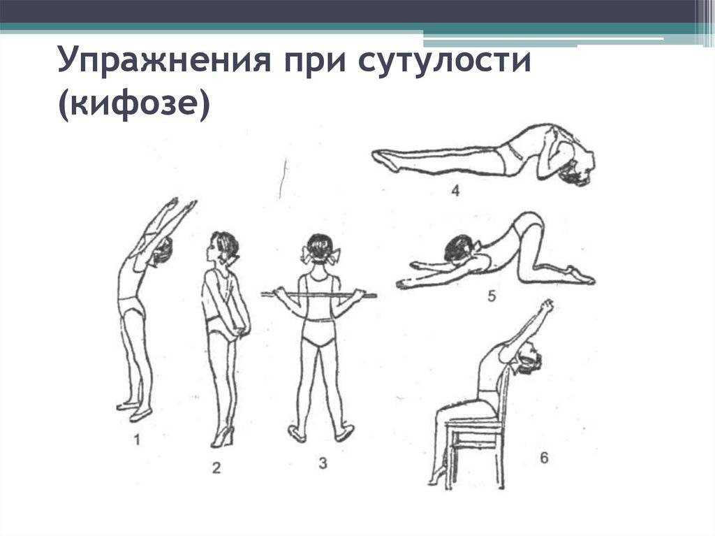 Боль в лопатках на спине - причины, типы болевых ощущений, лечение