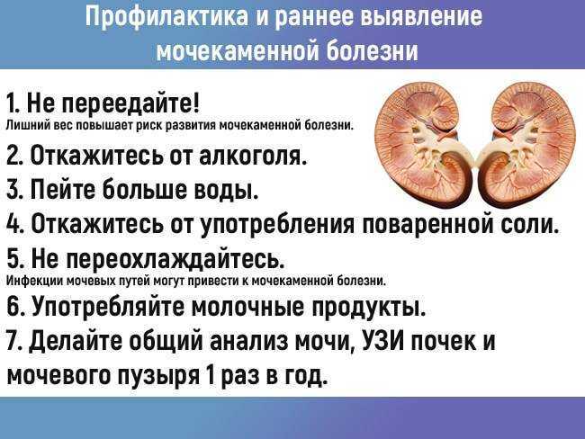 Камни почек. что нужно знать и как правильно лечить