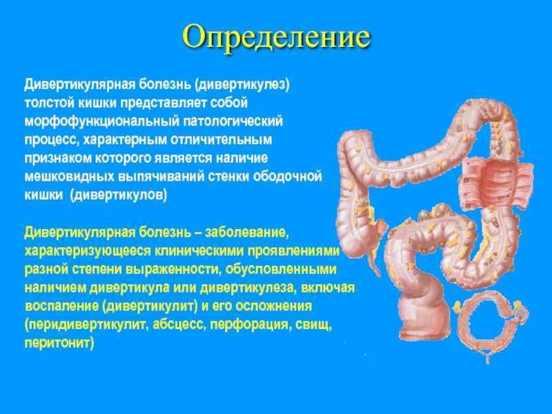 Проктит
