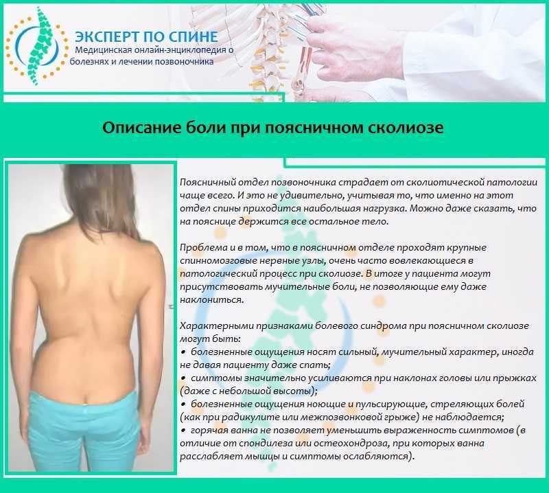 Миозит мышц спины