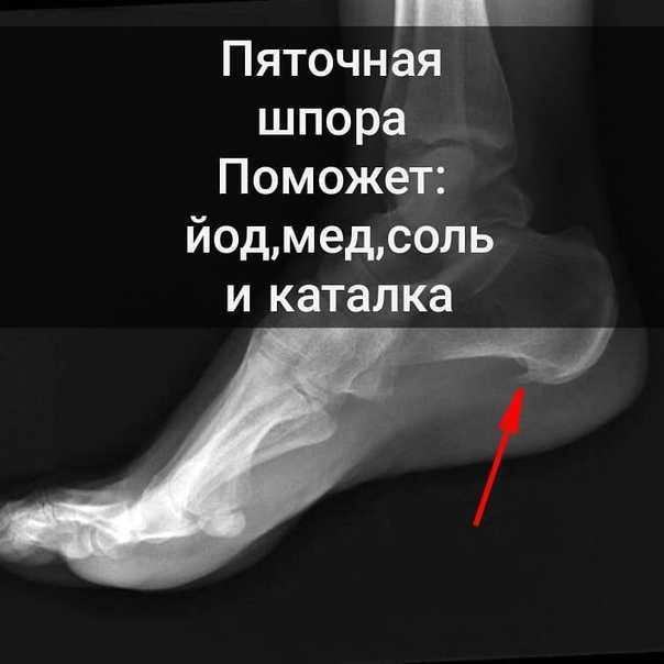 Массаж стоп и голеней. виды массажа и методика проведения | справочник массажиста медицинского центра диагностики, профилактики и лечения эндомедлаб на дмитровской.