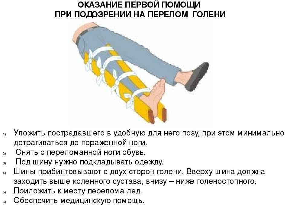 Травма, при которой нарушается целостность большеберцовой или малоберцовой кости и в зависимости от положения линии перелома, выделяют различные разновидности травмы