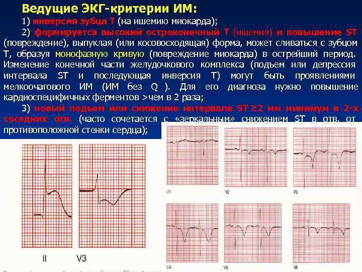 Митральные пороки сердца
