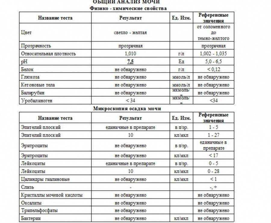 Анализ мочи по зимницкому