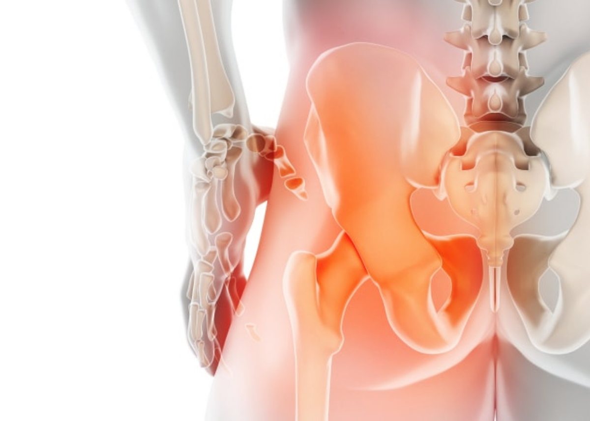 Артроз крестцово-подвздошных сочленений: симптомы и лечение