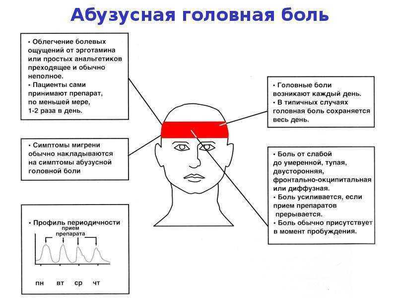 Мукоцеле или пиоцеле лобной пазухи!