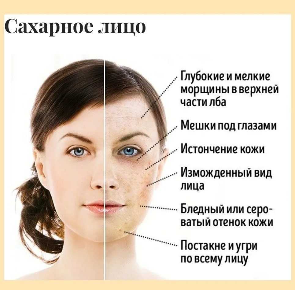 Цирроз печени: симптомы, лечение. сколько живут с циррозом