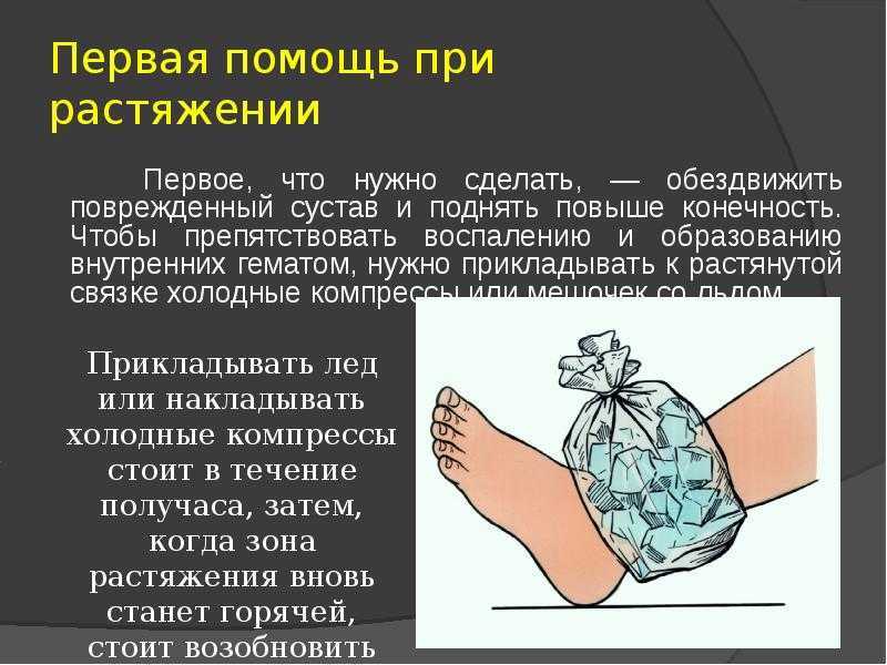 Вывих