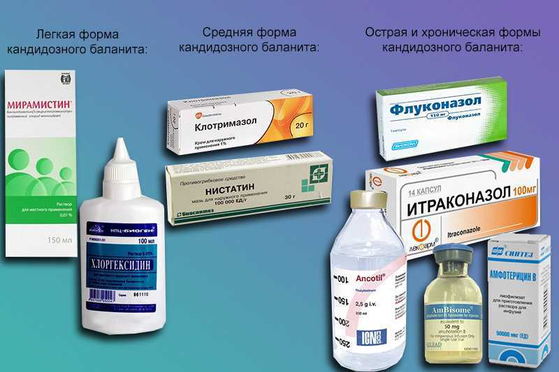 Баланопостит у мужчин лечение