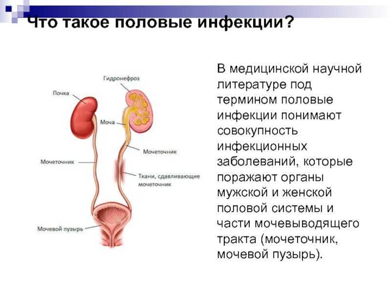 Трихомониаз: причины, симптомы и лечение