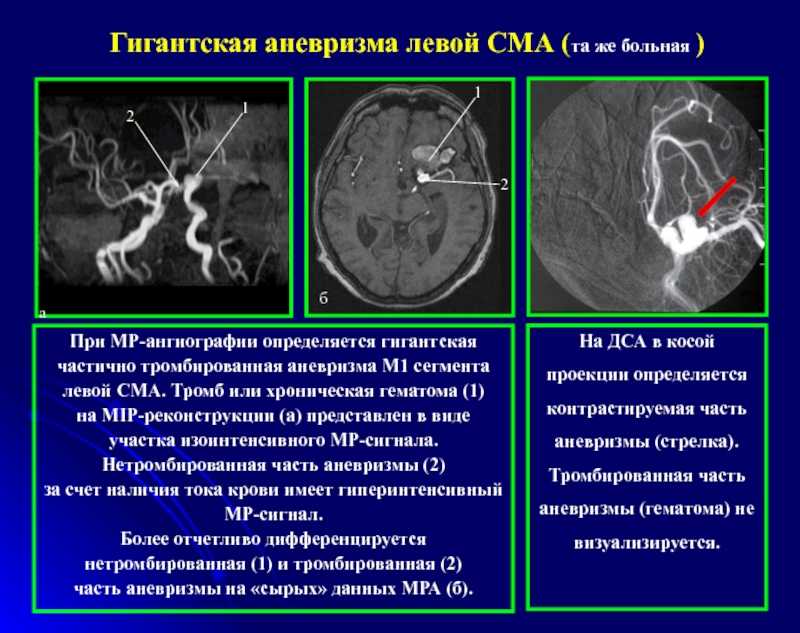 Заболевания вен | диагностика | документация нмхц пирогова
