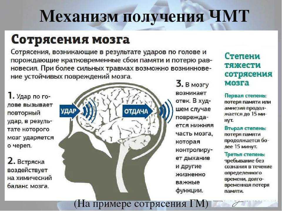 Сотрясение головного мозга