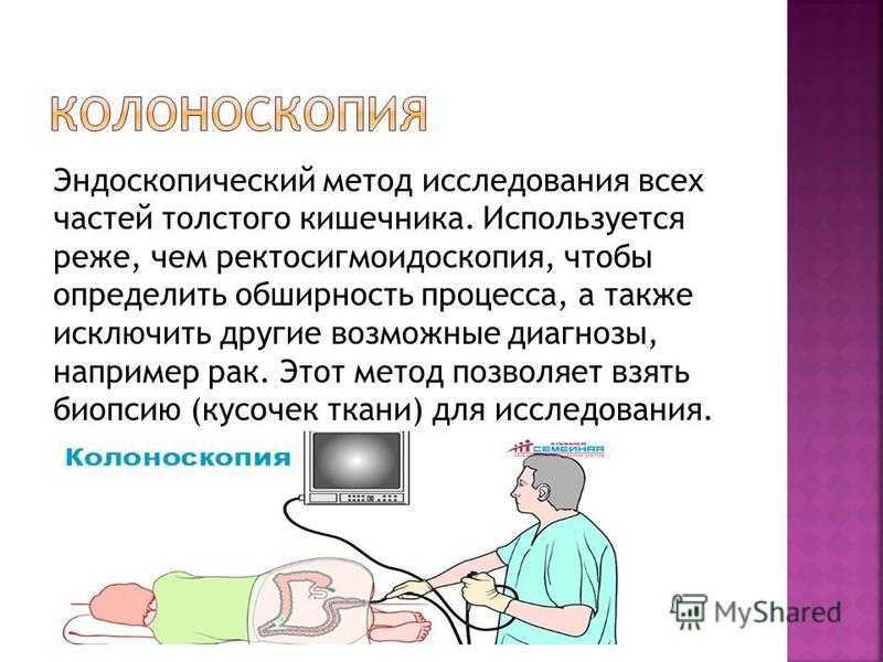 Колоноскопия