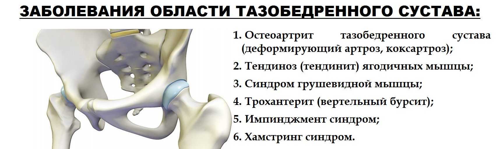 Артроз стопы