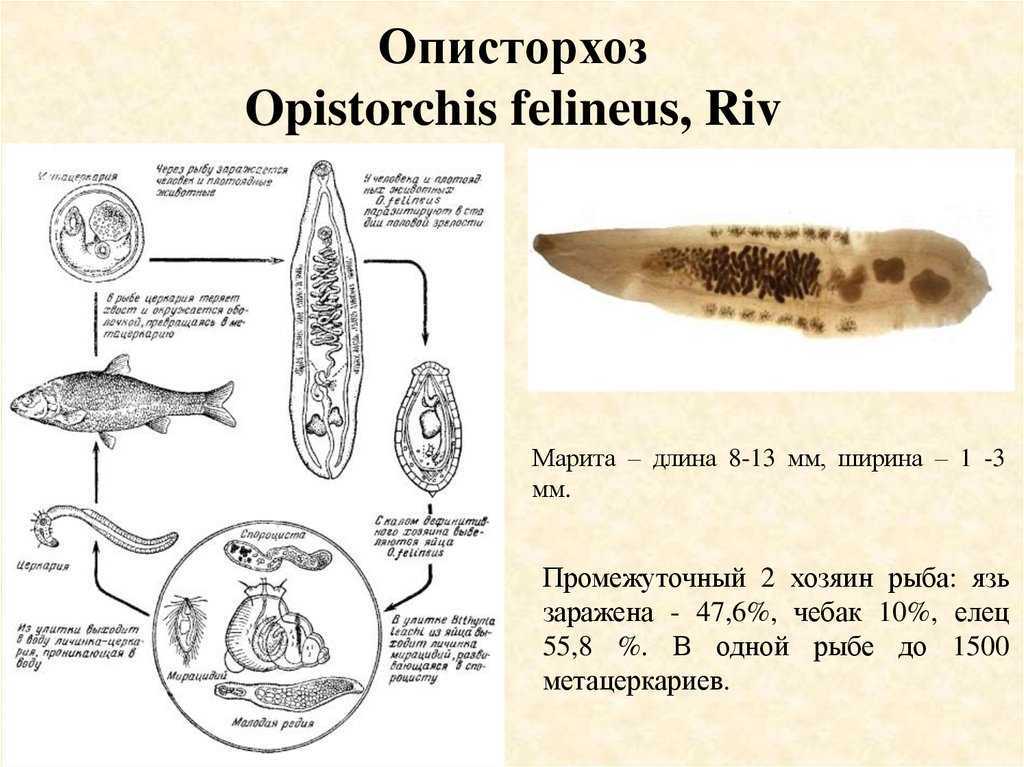 Описторхоз — большая медицинская энциклопедия