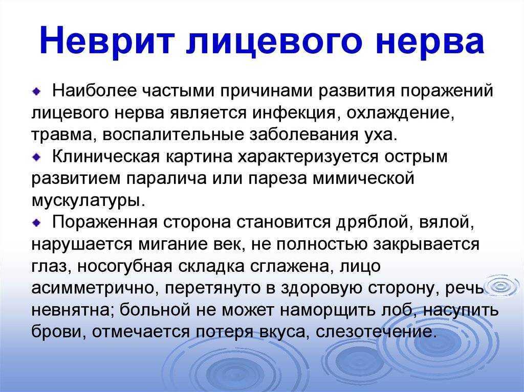 О неврите лицевого нерва и его восстановлении • crystal touch bell's palsy clinic