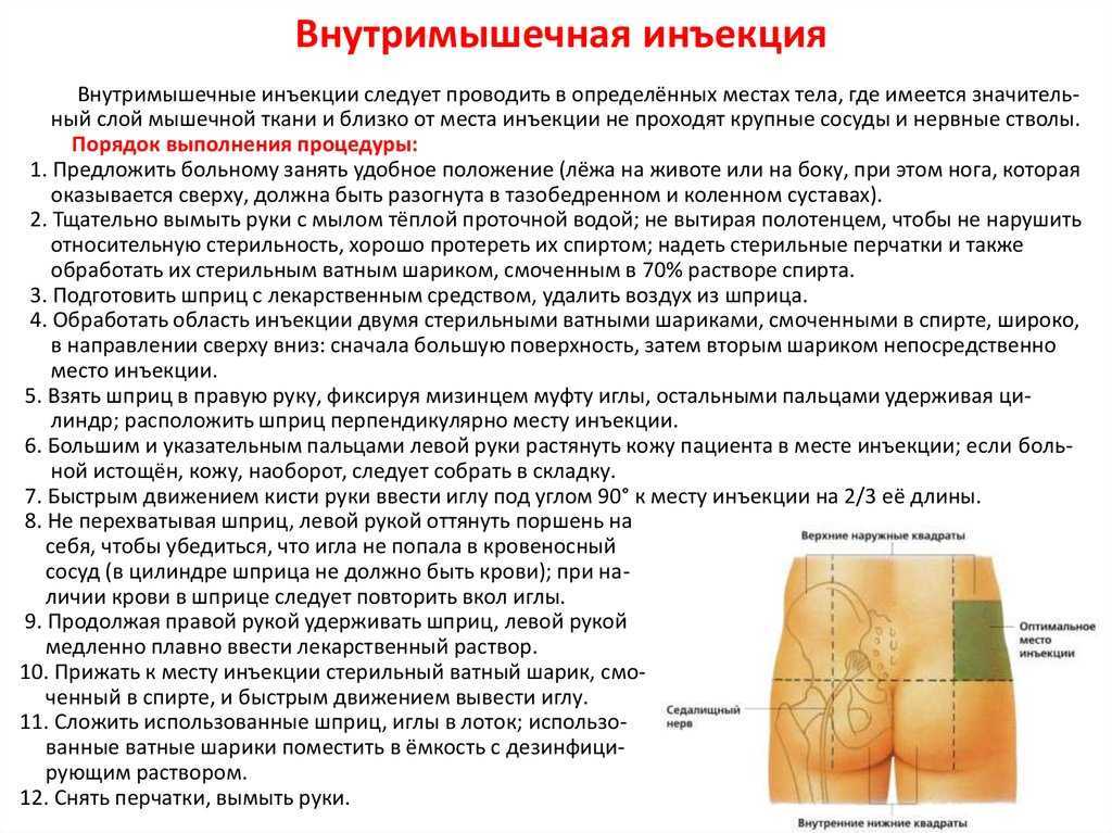 Как правильно самостоятельно колоть уколы в ягодицу