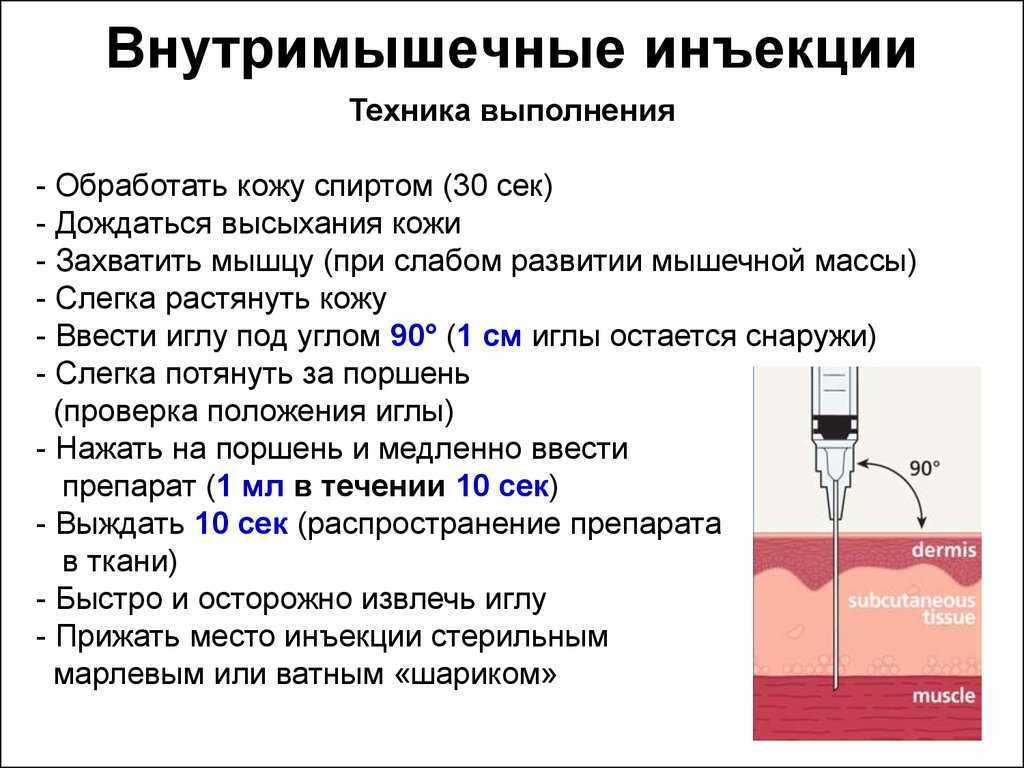Внутримышечное введение лекарственного препарата: необходимая подготовка и методика проведения | услуги клиники «проксима» (г. сочи)