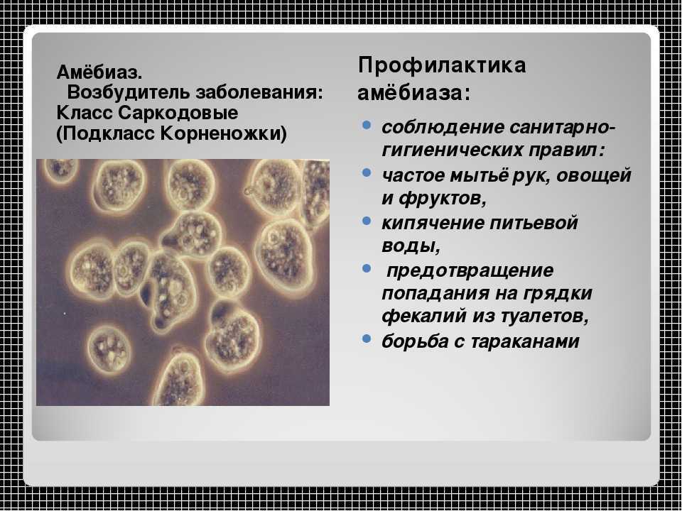 Энтеровирусная инфекция у детей