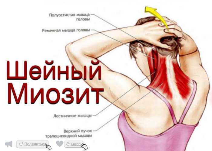 Глава 48. воспалительные заболевания мышц