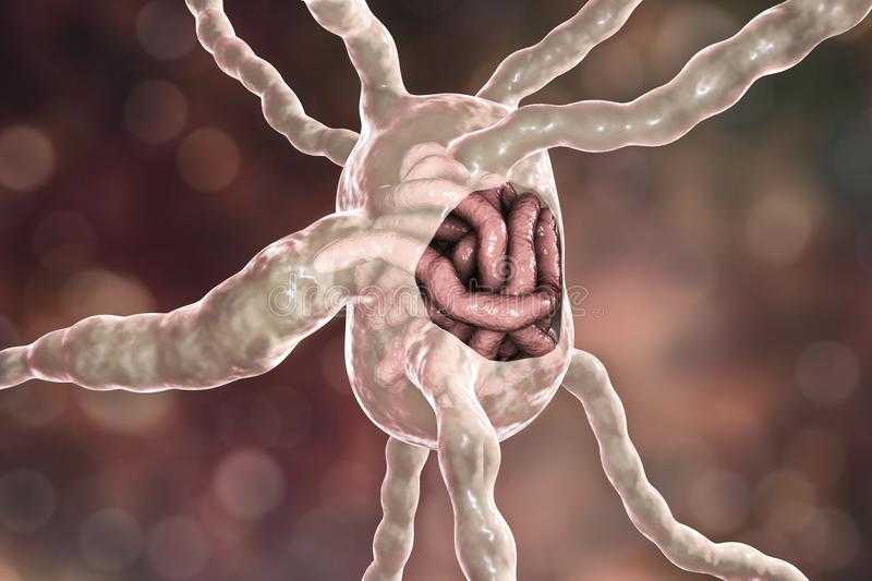 Инфекция сlostridium difficile