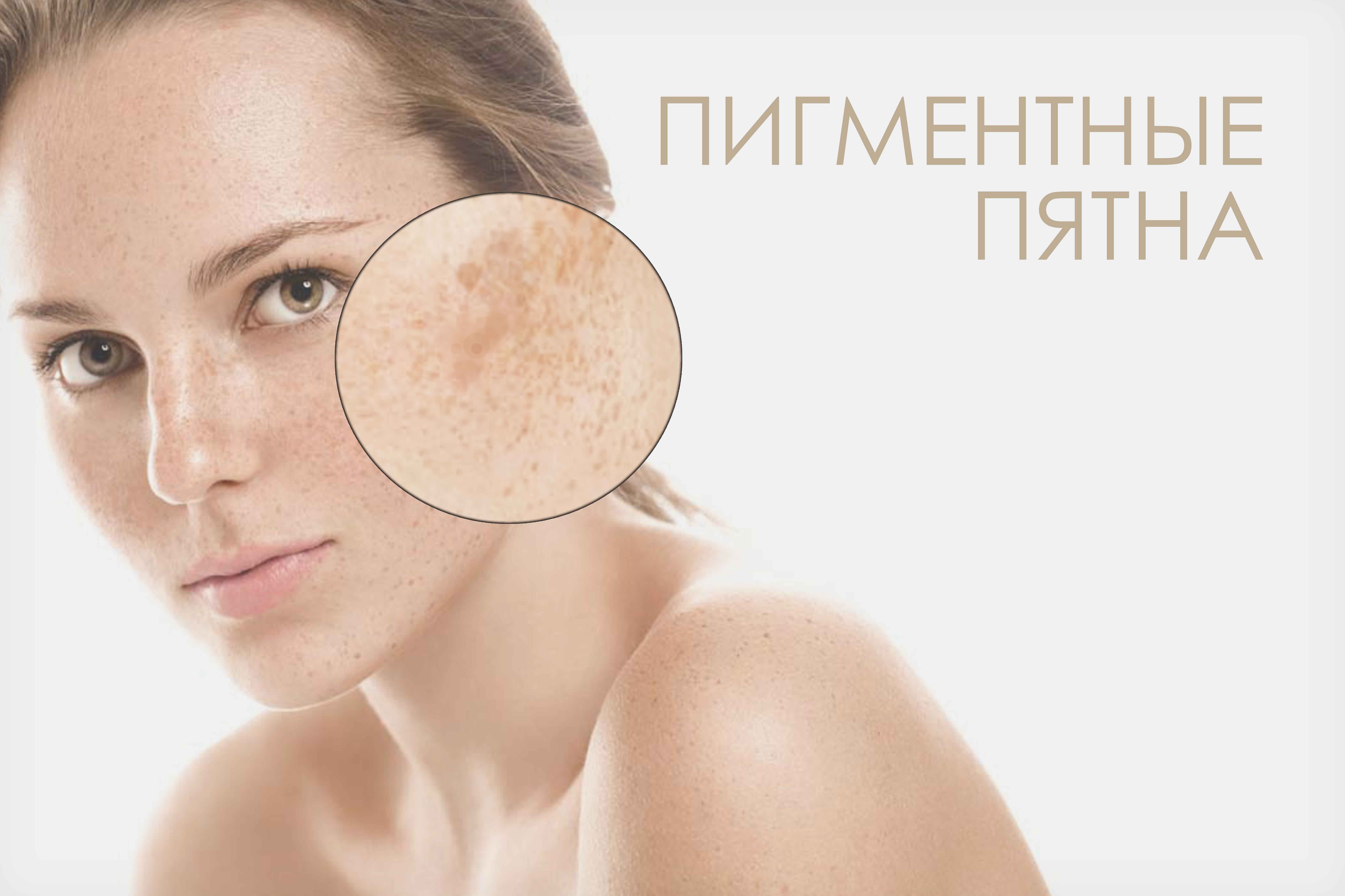 Лечение беспигментной меланомы