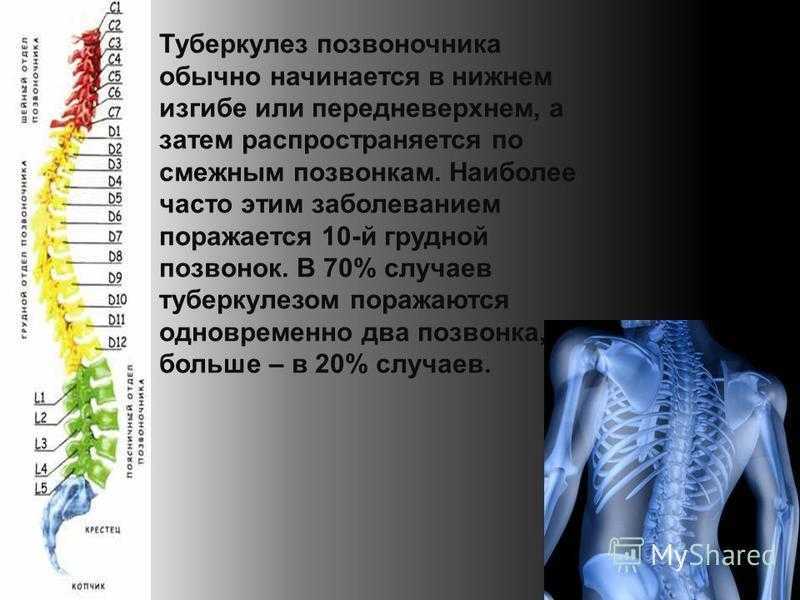 Туберкулез мочеполовой системы - симптомы, осложнения, диагностика | университетская клиника