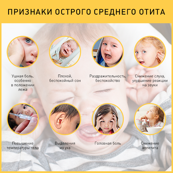 Средний отит