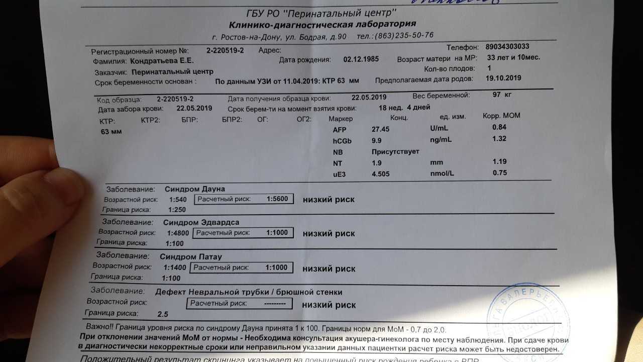 Синдром дауна: 4 механизма развития и 6 основных факторов риска хромосомной аномалии