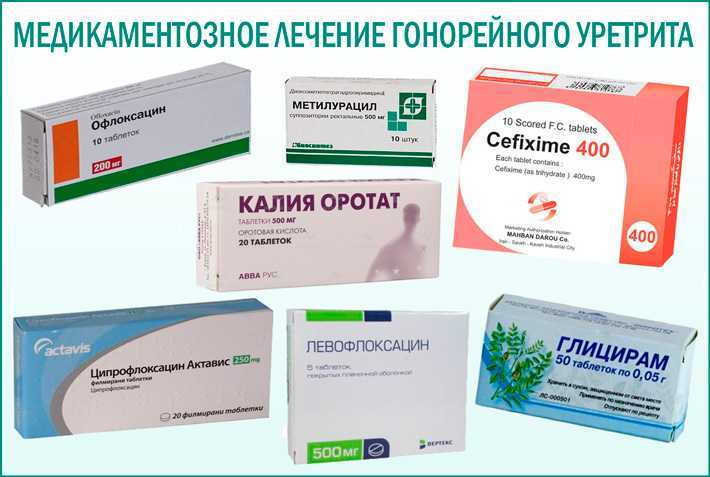 Уретрит, симптомы и признаки. лечение уретрита у мужчин и у женщин.