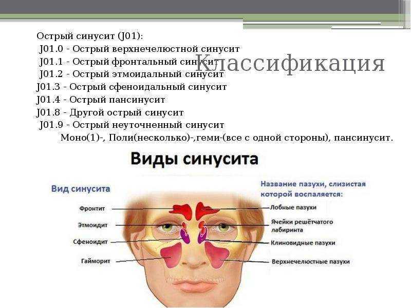 Фронтит (острый фронтальный синусит) - симптомы болезни, профилактика и лечение фронтита (острого фронтального синусита), причины заболевания и его диагностика на eurolab