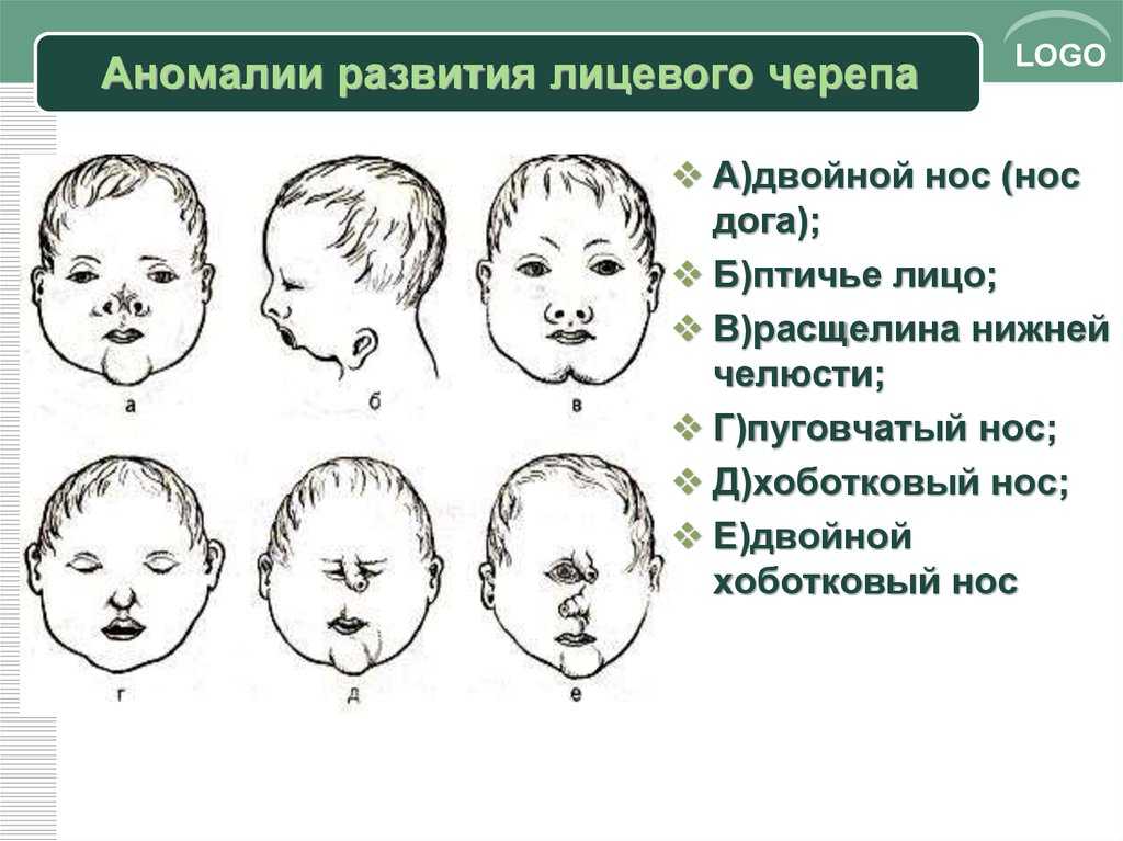 Операция заячья губа: как проходит пластика, что делать после исправления дефекта, виды - односторонее, двусторонее | marykay-4u.ru